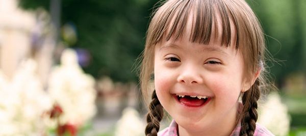 Criança com Síndrome de Down sorrindo